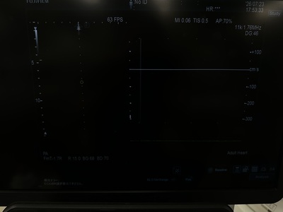 Ultrasound&nbsp;|&nbsp;FUJIFILM&nbsp;|&nbsp;ARIETTA 850SE