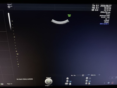 4D Ultrasound&nbsp;|&nbsp;GE&nbsp;|&nbsp;Voluson E10 BT20