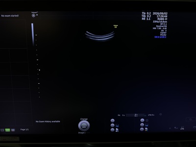 4D Ultrasound&nbsp;|&nbsp;GE&nbsp;|&nbsp;Voluson E8 BT17