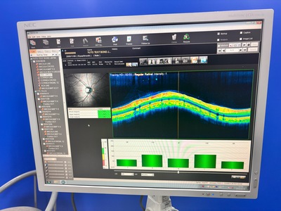 Fully Refurbished OCT with Angiography + Anterior Lens kit&nbsp;|&nbsp;NIDEK&nbsp;|&nbsp;RS-3000 Advance