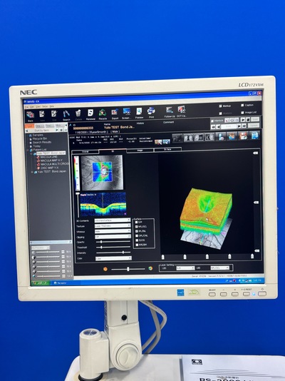 High-performance SD-OCT at the best price for private practitioners. — Nidek RS-3000 Lite&nbsp;|&nbsp;NIDEK&nbsp;|&nbsp;RS-3000 Lite