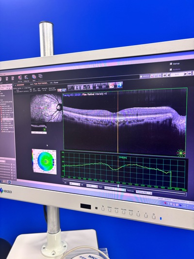 ANGIOGRAPHY Installed. No injections required. An unprecedented, high-definition 3D map of retinal blood flow drawn with light.&nbsp;|&nbsp;NIDEK&nbsp;|&nbsp;RS-3000 Advance