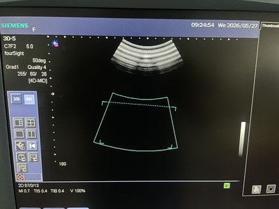 Ulltrasound&nbsp;|&nbsp;SIEMENS&nbsp;|&nbsp;Sonovista X500