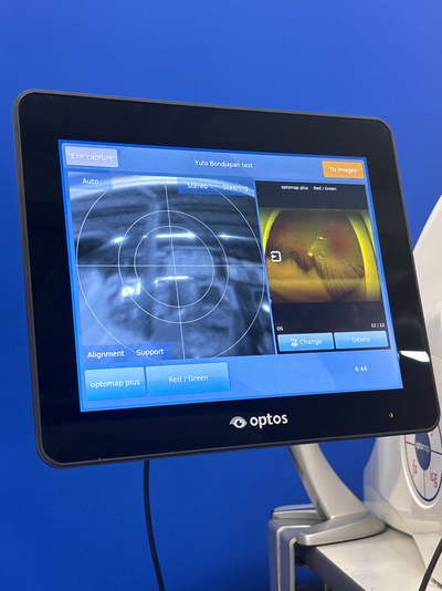 Color RG,af,fa,icg, 200° ultra-widefield retinal image&nbsp;|&nbsp;Optos, Inc. (Nikon)&nbsp;|&nbsp;California