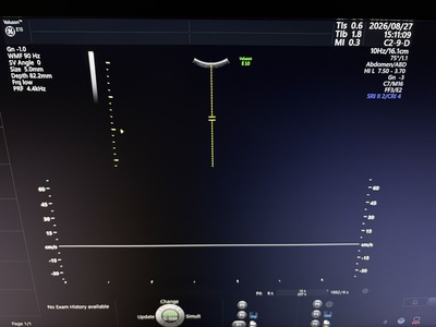 4D Ultrasound&nbsp;|&nbsp;GE&nbsp;|&nbsp;Voluson E10 BT20