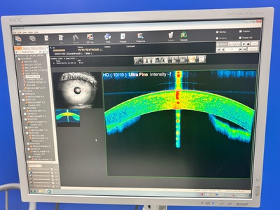 Fully Refurbished OCT with Angiography + Anterior Lens kit&nbsp;|&nbsp;NIDEK&nbsp;|&nbsp;RS-3000 Advance