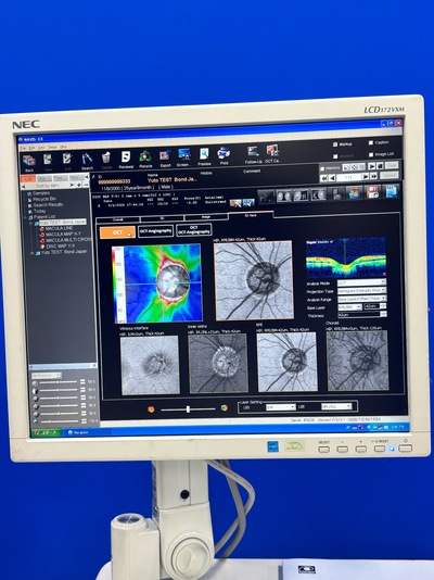 High-performance SD-OCT at the best price for private practitioners. — Nidek RS-3000 Lite&nbsp;|&nbsp;NIDEK&nbsp;|&nbsp;RS-3000 Lite