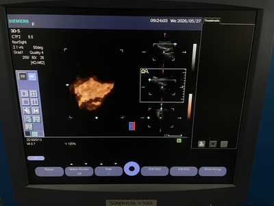 Ulltrasound&nbsp;|&nbsp;SIEMENS&nbsp;|&nbsp;Sonovista X500