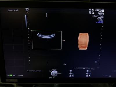 4D Ultrasound&nbsp;|&nbsp;GE&nbsp;|&nbsp;Voluson E8 BT17