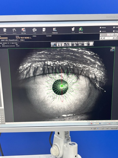Fully Refurbished OCT with Angiography + Anterior Lens kit&nbsp;|&nbsp;NIDEK&nbsp;|&nbsp;RS-3000 Advance