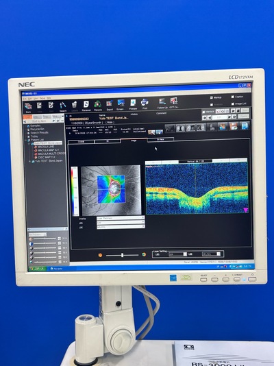 High-performance SD-OCT at the best price for private practitioners. — Nidek RS-3000 Lite&nbsp;|&nbsp;NIDEK&nbsp;|&nbsp;RS-3000 Lite