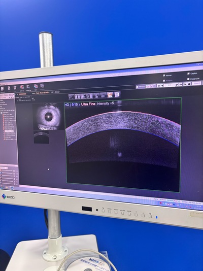 ANGIOGRAPHY Installed. No injections required. An unprecedented, high-definition 3D map of retinal blood flow drawn with light.&nbsp;|&nbsp;NIDEK&nbsp;|&nbsp;RS-3000 Advance