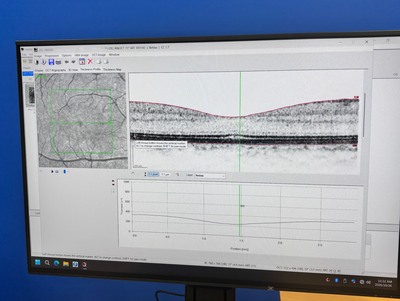 現行最高峰の医療資産-マルチモーダルイメージングプラットフォーム 「SPECTRALIS（スペクトラリス）with SHIFT Technology / 2023年製造モデル」&nbsp;|&nbsp;株式会社 JFC セールスプラン&nbsp;|&nbsp;OCT SHIFTの写真