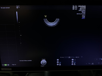 4D Ultrasound&nbsp;|&nbsp;GE&nbsp;|&nbsp;Voluson E8 BT17