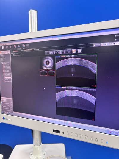 ANGIOGRAPHY Installed. No injections required. An unprecedented, high-definition 3D map of retinal blood flow drawn with light.&nbsp;|&nbsp;NIDEK&nbsp;|&nbsp;RS-3000 Advance