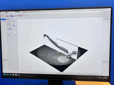 現行最高峰の医療資産-マルチモーダルイメージングプラットフォーム 「SPECTRALIS（スペクトラリス）with SHIFT Technology / 2023年製造モデル」&nbsp;|&nbsp;株式会社 JFC セールスプラン&nbsp;|&nbsp;OCT SHIFTの写真
