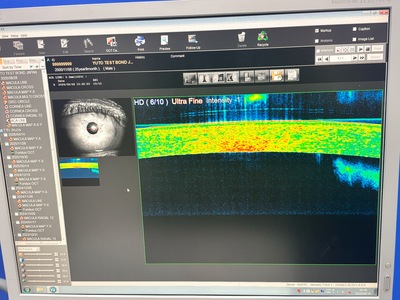 Fully Refurbished OCT with Angiography + Anterior Lens kit&nbsp;|&nbsp;NIDEK&nbsp;|&nbsp;RS-3000 Advance