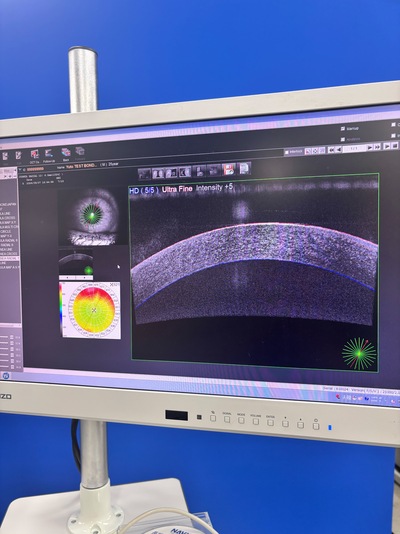 ANGIOGRAPHY Installed. No injections required. An unprecedented, high-definition 3D map of retinal blood flow drawn with light.&nbsp;|&nbsp;NIDEK&nbsp;|&nbsp;RS-3000 Advance