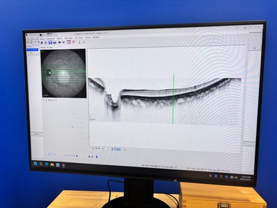 現行最高峰の医療資産-マルチモーダルイメージングプラットフォーム 「SPECTRALIS（スペクトラリス）with SHIFT Technology / 2023年製造モデル」&nbsp;|&nbsp;株式会社 JFC セールスプラン&nbsp;|&nbsp;OCT SHIFTの写真