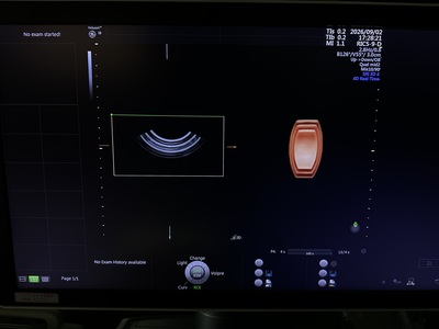 4D Ultrasound&nbsp;|&nbsp;GE&nbsp;|&nbsp;Voluson E8 BT17