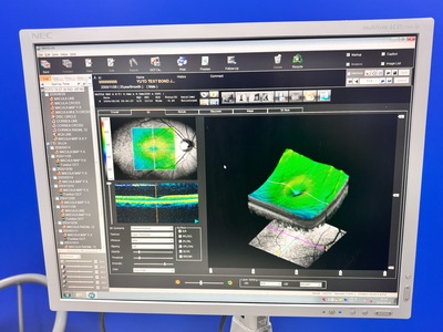 Fully Refurbished OCT with Angiography + Anterior Lens kit&nbsp;|&nbsp;NIDEK&nbsp;|&nbsp;RS-3000 Advance