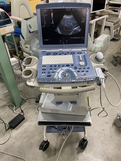 4D Ultrasound GE Voluson e