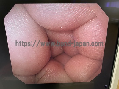 Video Gastroscope&nbsp;|&nbsp;OLYMPUS&nbsp;|&nbsp;GIF-Q240