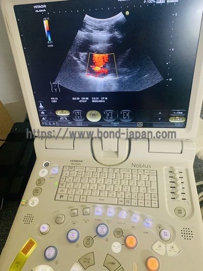 Ultrasound|HITACHI|Noblus