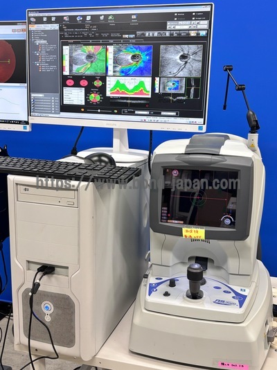  Optical Coherence Tomography ・OCT|NIDEK|RS-3000 Lite