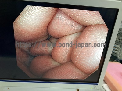 大腸スコープ | オリンパス | PCF-H290Iの写真