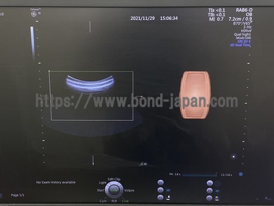 4D超音波診断装置 | SBJ | 17040