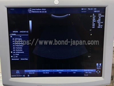 Color Doppler&nbsp;|&nbsp;GE&nbsp;|&nbsp;LOGIQ P5