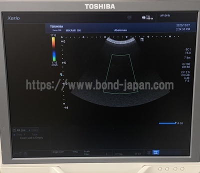 Color Doppler | CANON | TUS-X100 Xario 100