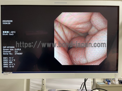上部消化管ビデオスコープ | オリンパス | GIF-XP290Nの写真