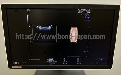 4D Ultrasound | GE | Voluson E10 BT19