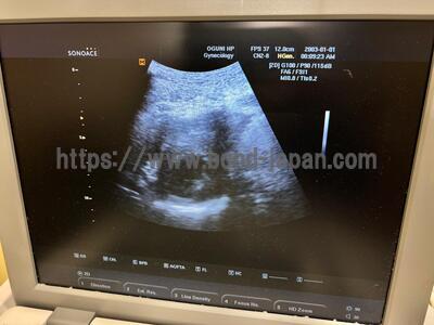 Ultrasound | Samsung Medison | SonoAce R3