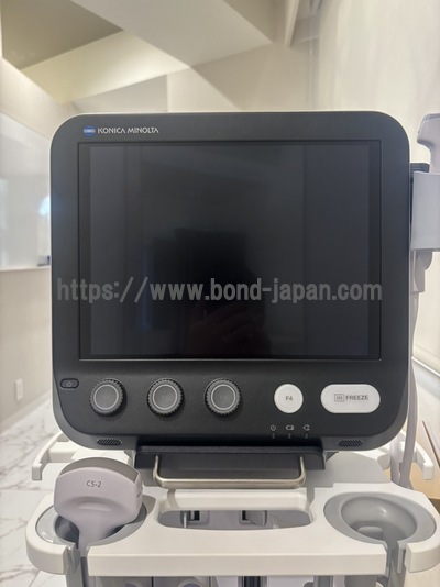 超音波診断装置 | コニカミノルタジャパン株式会社 | SONIMAGE MX1の写真