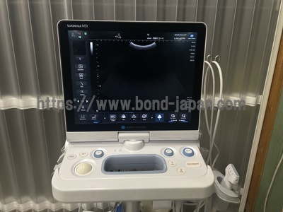 Ultrasound | konica | SONIMAGE HS1