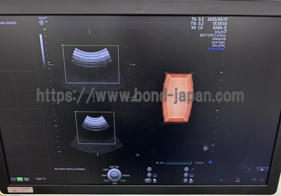 4D Ultrasound | GE | Voluson E8 BT18