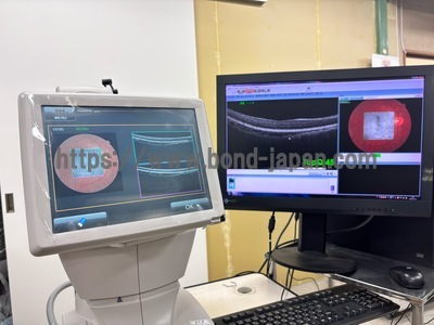 OCT | TOPCON | 3D OCT 1 / Maestro 1