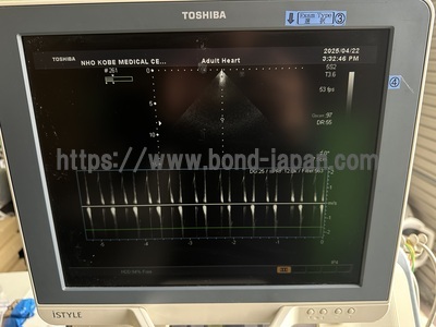 Color Doppler | CANON | SSA-660A Xario