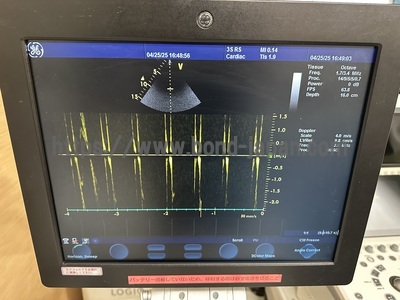 Color Doppler | GE | Vivid S6