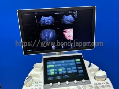 4D Ultrasound | GE | Voluson E8 BT15