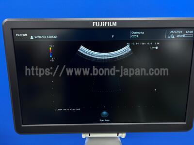 Ultrasound System | FUJIFILM | ARIETTA 50