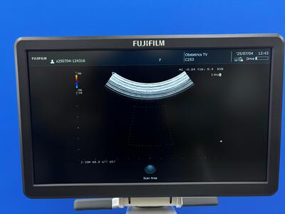 Ultrasound System&nbsp;|&nbsp;FUJIFILM&nbsp;|&nbsp;ARIETTA 50