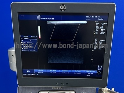 Color Doppler | GE | LOGIQ P6