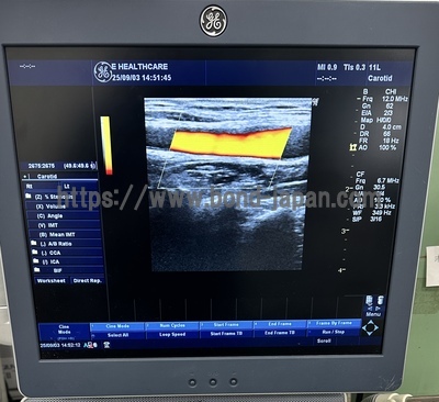Color Doppler | GE | LOGIQ P6