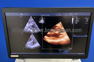 Color Doppler | GE | Vivid E95 Urtla Edition