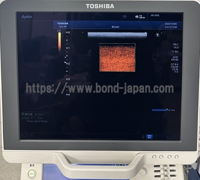 Color Doppler | CANON | Aplio 300