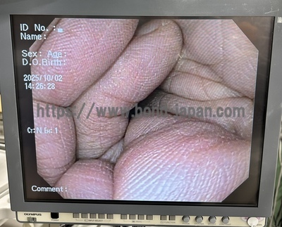 Video Gastroscope | OLYMPUS | GIF-Q150X